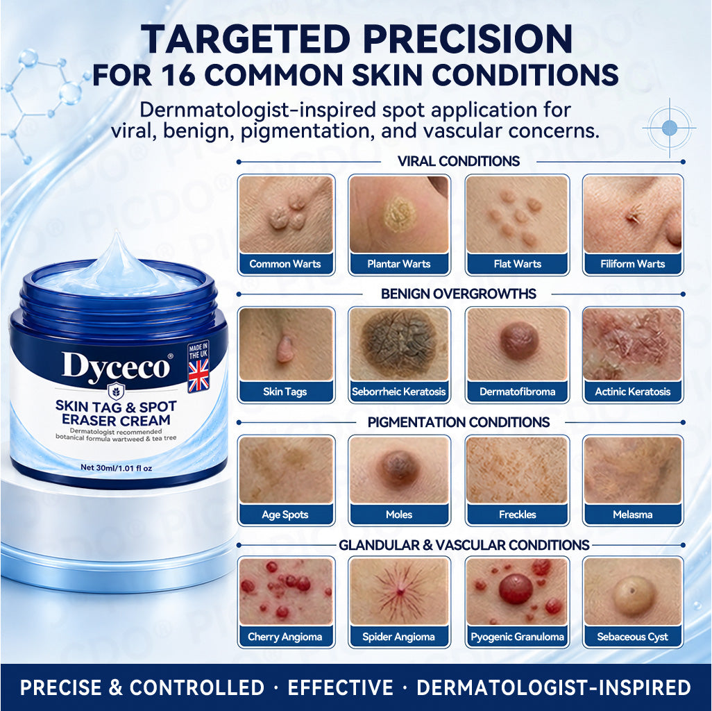 Dyceco® 🚑 | 7-𝐃𝐚𝐲 𝐒𝐤𝐢𝐧 𝐓𝐚𝐠 & 𝐒𝐩𝐨𝐭 𝐄𝐫𝐚𝐬𝐞𝐫 𝐂𝐫𝐞𝐚𝐦 (Zero Pain, Zero 𝐒𝐜𝐚𝐫𝐬 Formula)