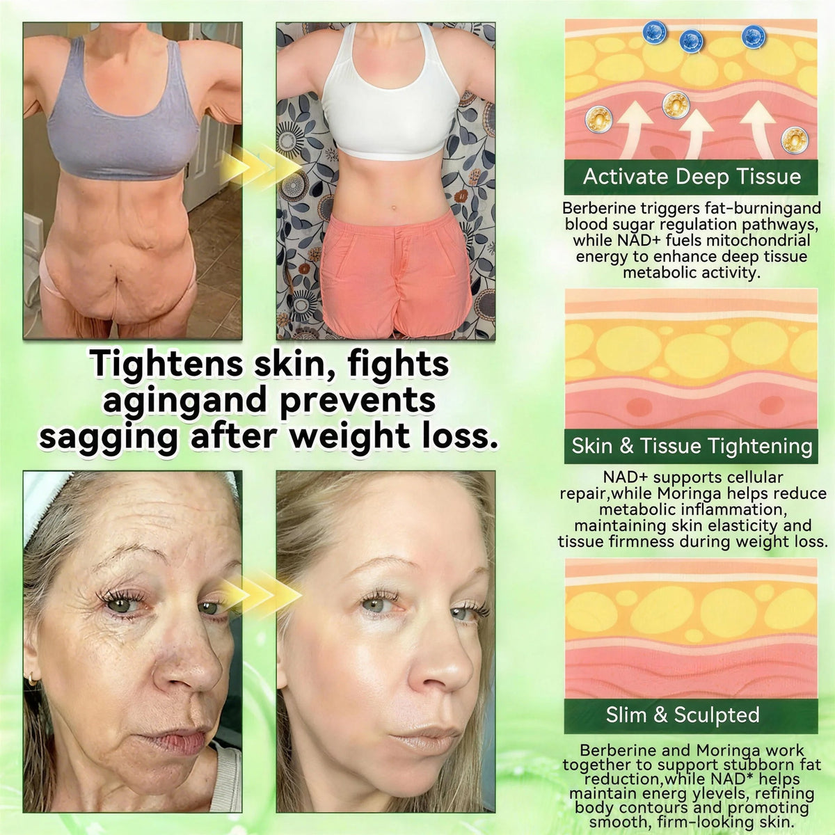 𝑶𝒇𝒇𝒊𝒄𝒊𝒂𝒍 𝒔𝒕𝒐𝒓𝒆  | 🇺🇸Surgoᴎix®  ☘️𝐌𝐨𝐫𝐢𝐧𝒈𝗮 𝑩𝒆𝒓𝒃𝒆𝐫𝐢𝐧𝐞𝐱 𝐍𝗔𝒟+ 10-𝑖n-1 𝐍a𝒏𝒐 𝐌𝐢𝐜𝐫𝑜𝑛𝑒𝑒𝗱𝗹𝗲 𝐏𝐚𝒕𝒄𝒉 (𝐉𝐮𝐬𝐭 𝐨𝐧𝐜𝐞 𝐚 𝐝𝐚𝐲, 𝐯𝐢𝐬𝐢𝐛𝐥𝐞 𝐜𝐡𝐚𝐧𝐠𝐞𝐬 𝐢𝐧 𝟕 𝑫𝐚𝐲𝐬） 𝐅𝐨𝐫 𝐎𝐛𝐞𝐬𝐢𝐭𝐲,  𝙇𝙊𝙊𝙎𝗘 𝗦𝗞𝗜𝗡,𝐝𝐢𝐚𝐛𝐞𝐭𝙚𝙨, 𝐬𝐥𝐞𝐞𝐏 𝐚𝐩𝐧𝐞𝐚, 𝐣𝐨𝐢𝐧𝐭 𝐢𝐬𝐬𝐮𝙚𝙨, 𝐚𝐧𝐝 𝐦𝐨𝐫𝐞 ✨